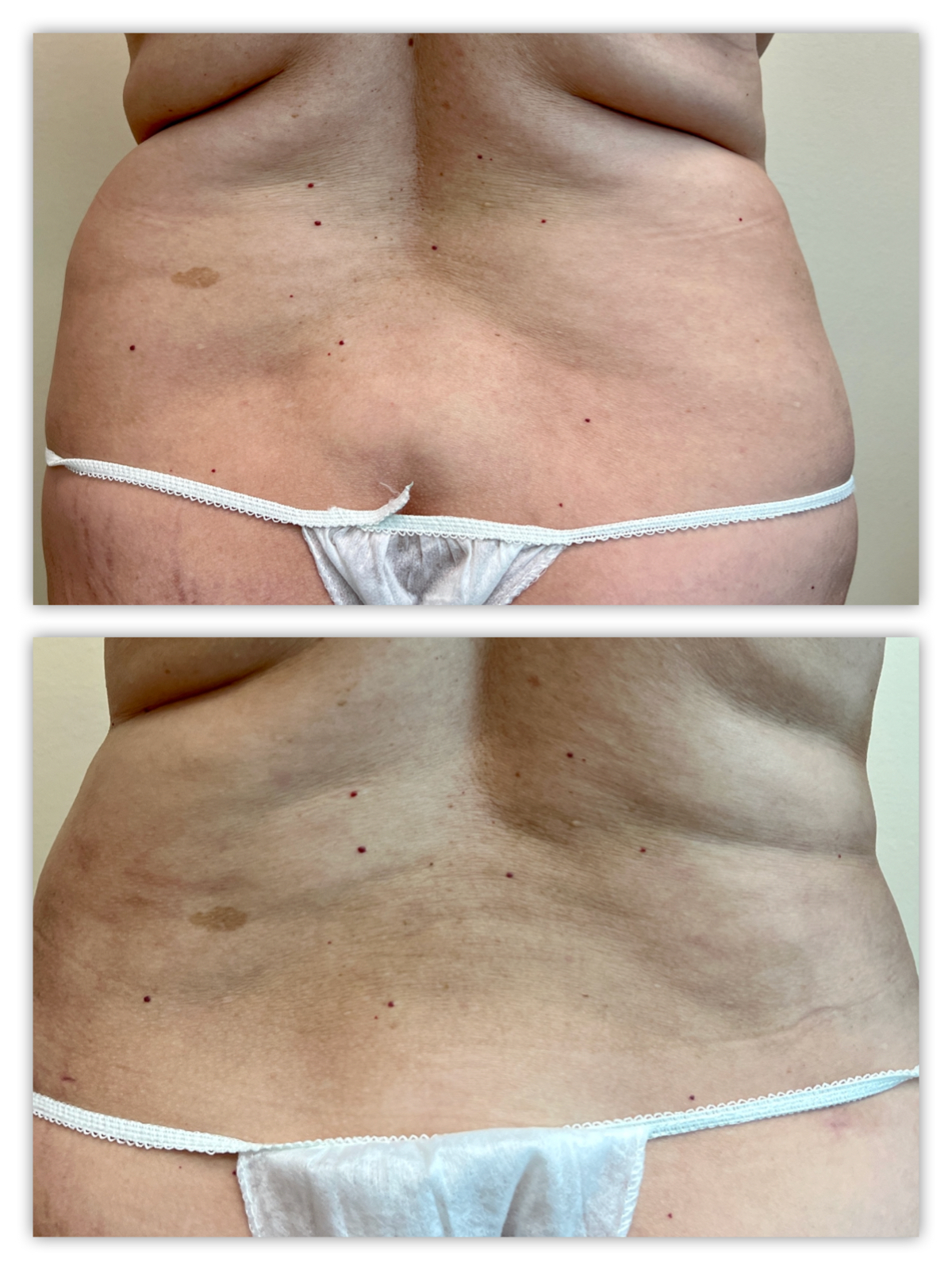 Before and After Image