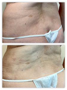 Before and After Image