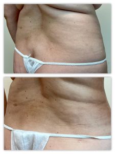 Before and After Image