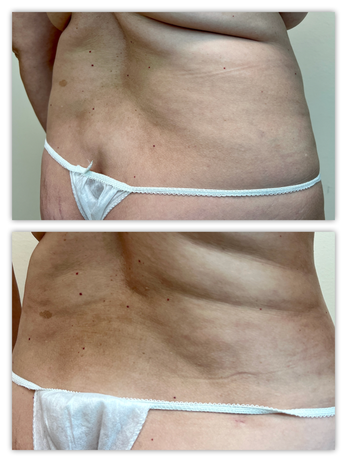 Before and After Image