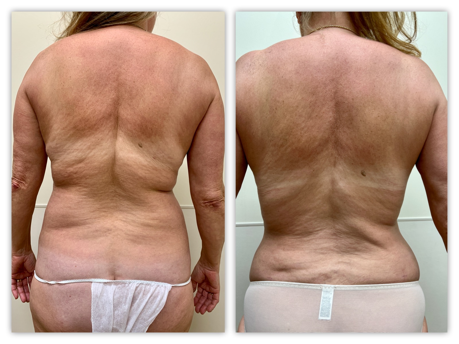 Before and After Image