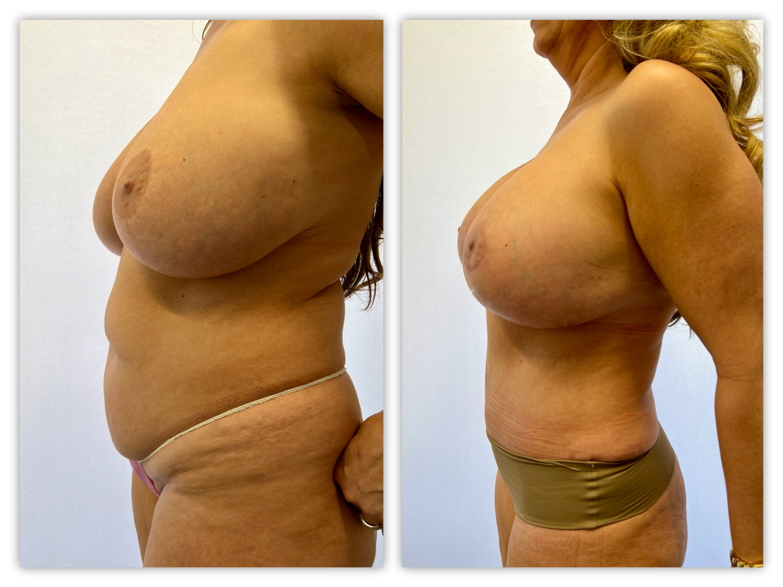 Before and After Image