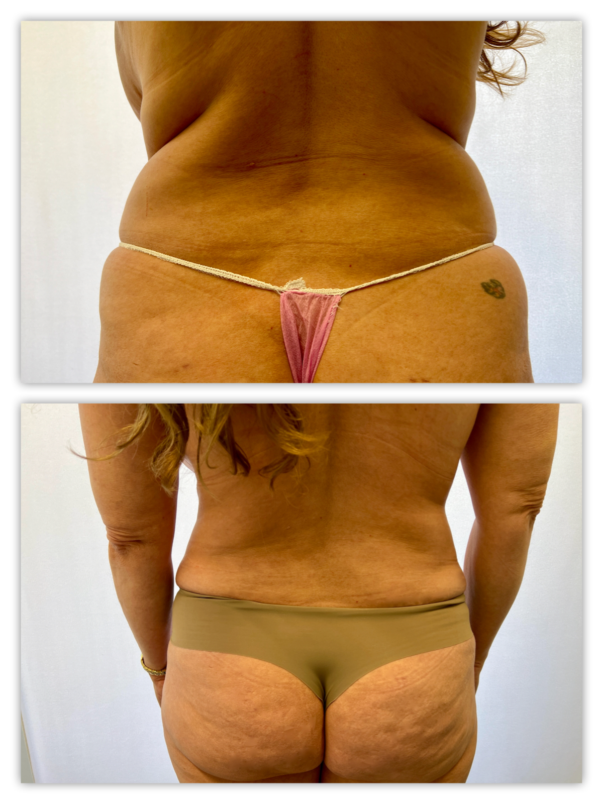 Before and After Image