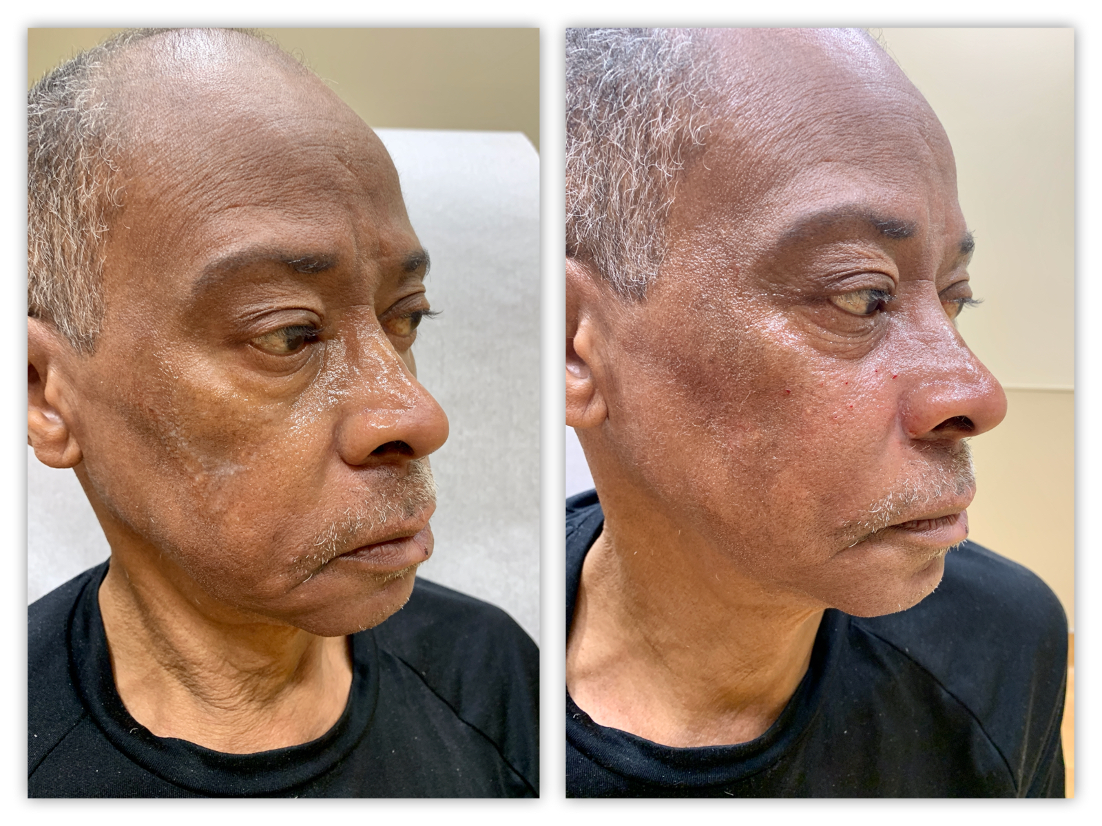 Before and After Image