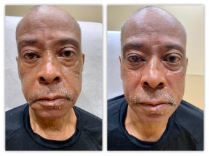 Before and After Image