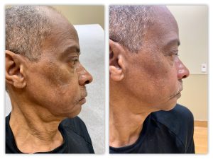 Before and After Image