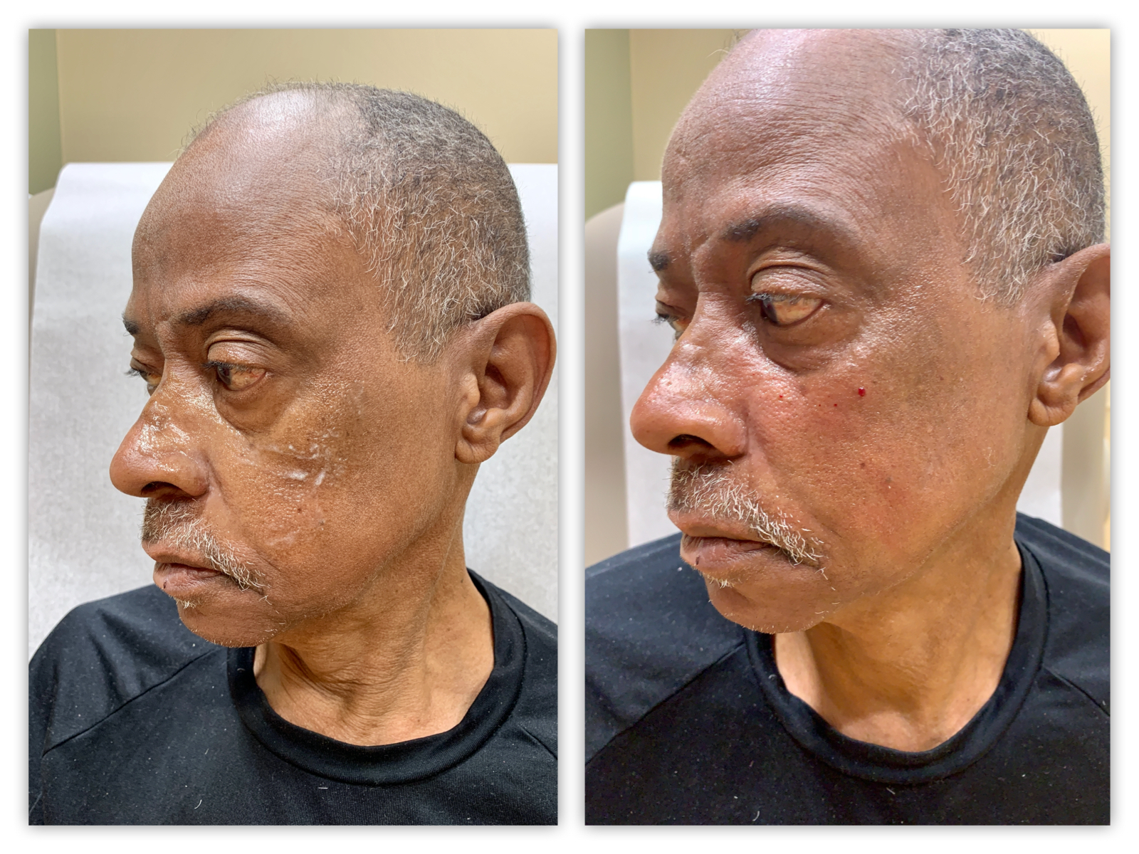 Before and After Image