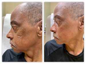 Before and After Image