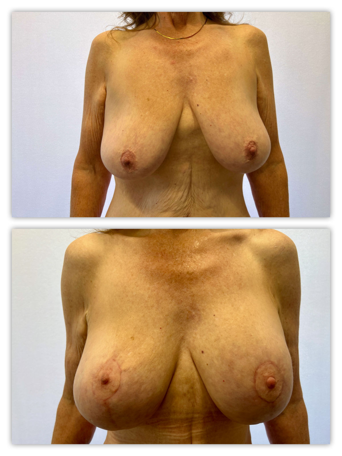 Before and After Image