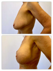 Before and After Image