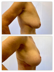 Before and After Image