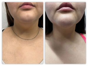 Before and After Image