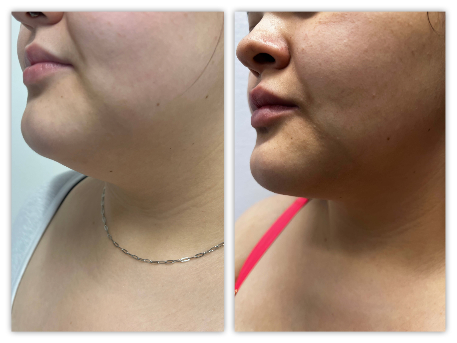 Before and After Image