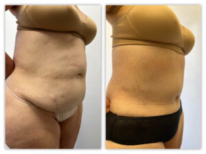 Before and After Image