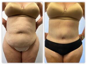 Before and After Image