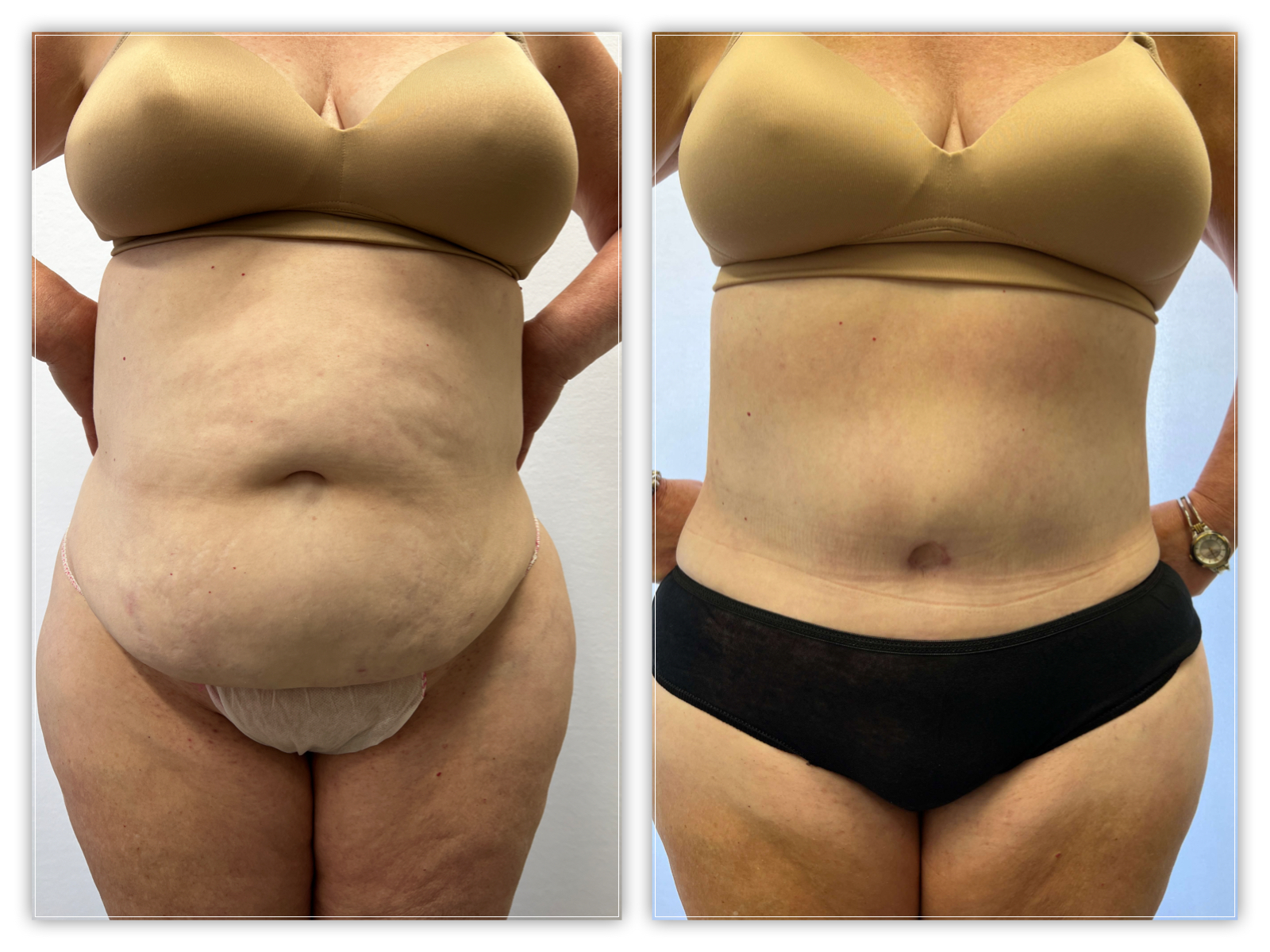 Before and After Image