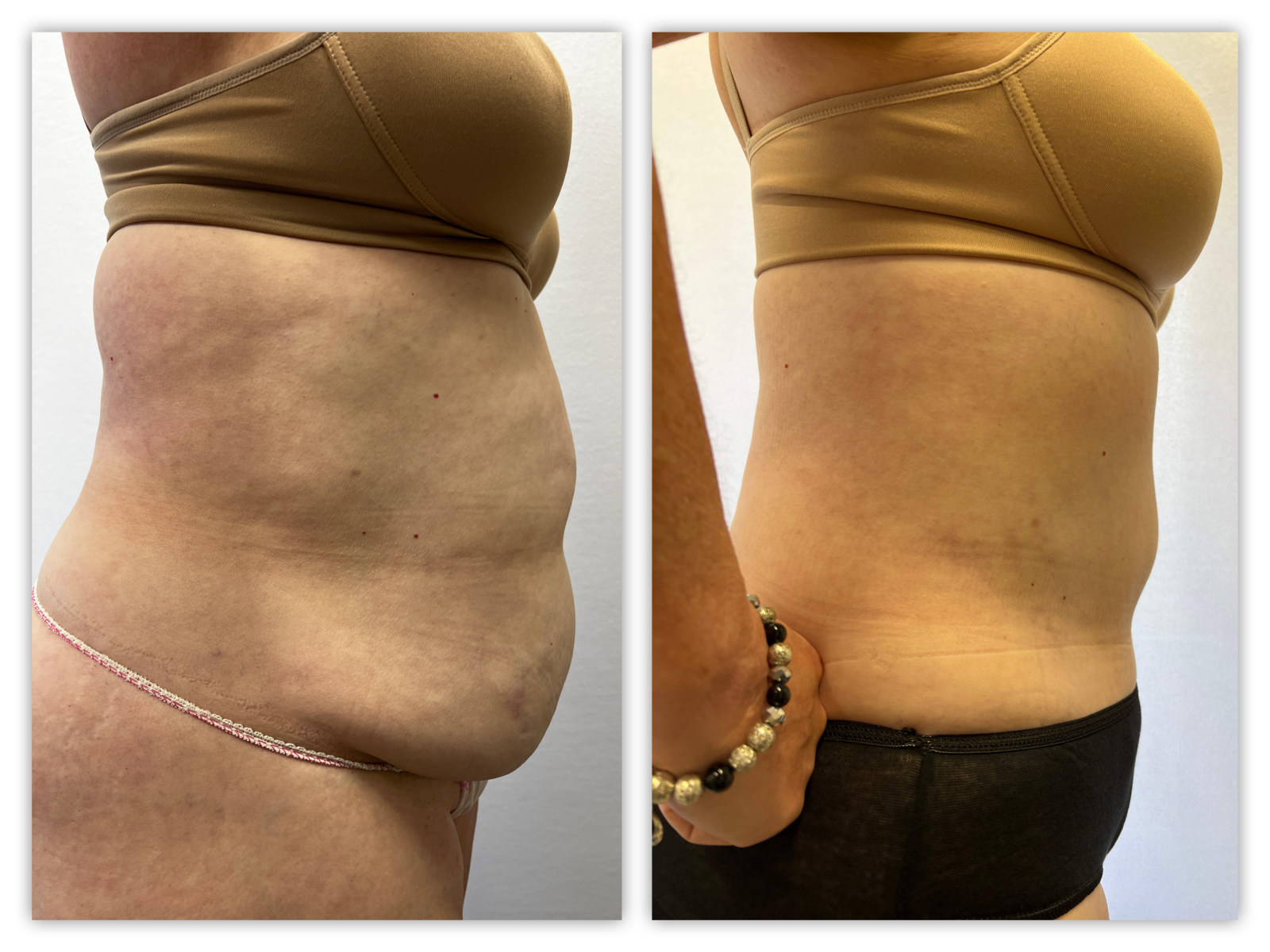 Before and After Image