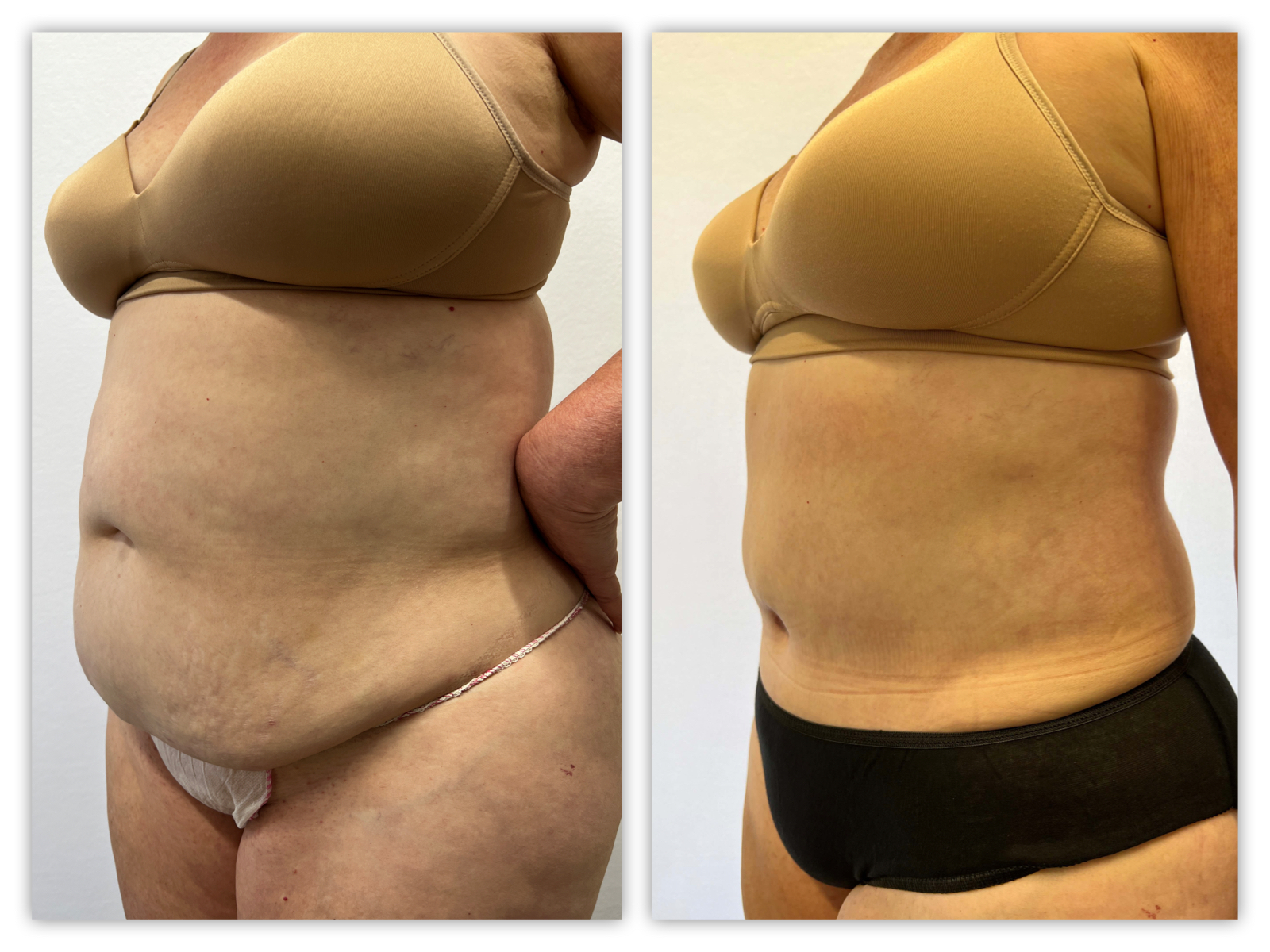 Before and After Image