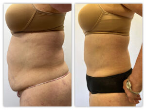 Before and After Image