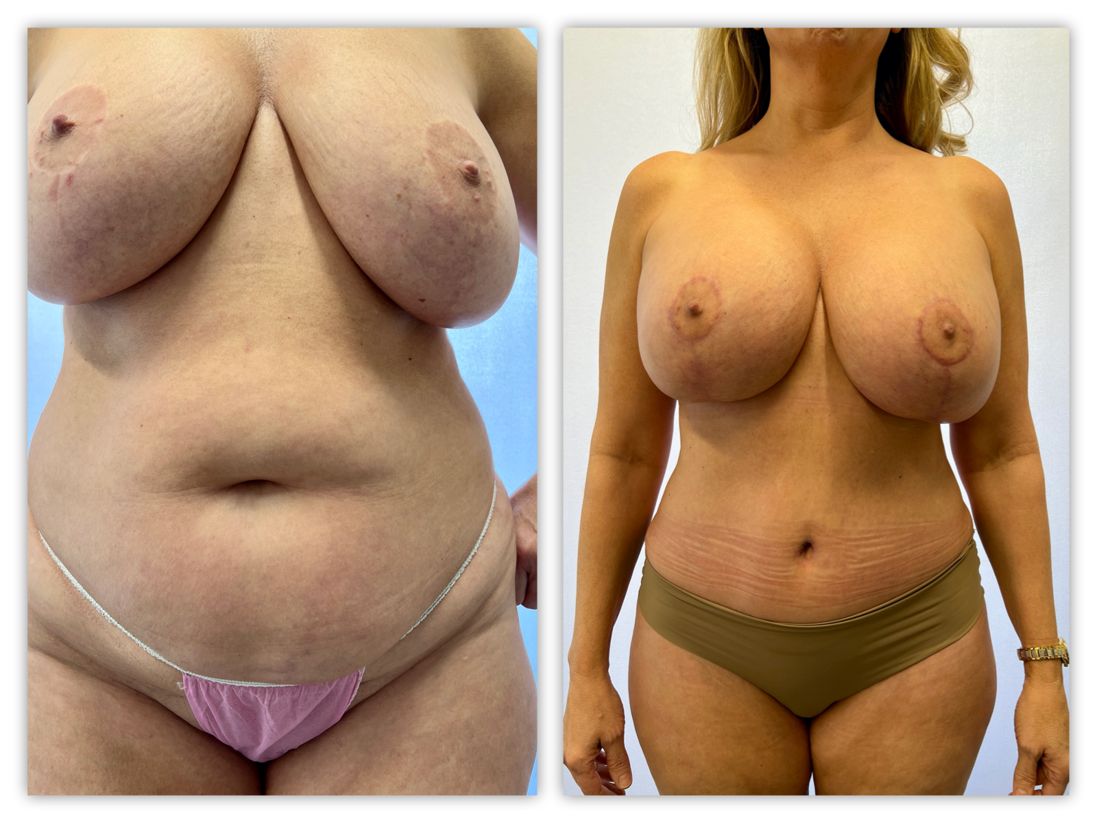 Before and After Image
