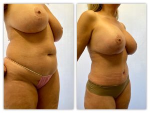 Before and After Image