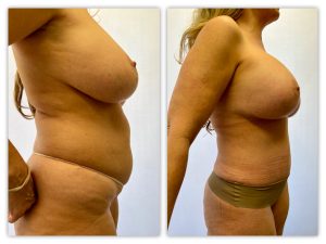 Before and After Image