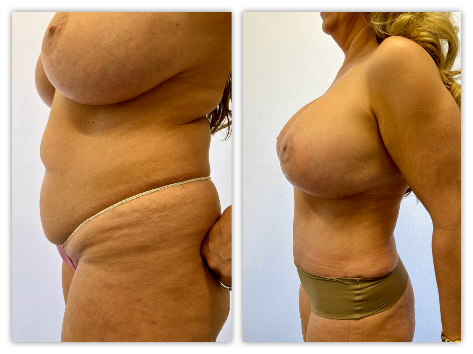 Before and After Image
