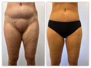 Before and After Image