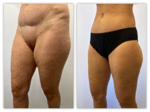 Before and After Image