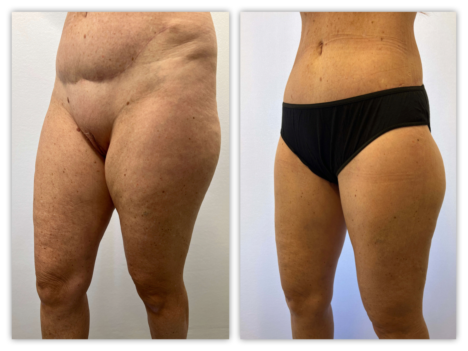 Before and After Image