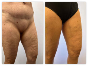 Before and After Image