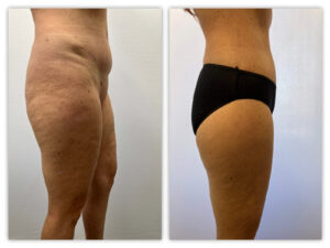 Before and After Image