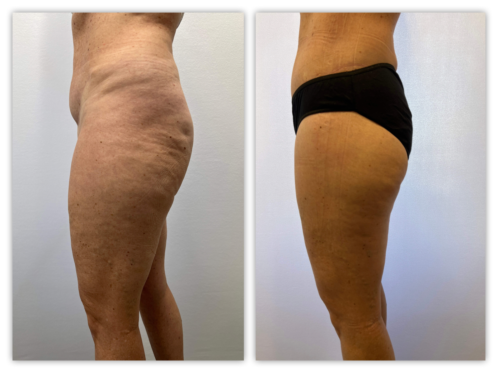 Before and After Image