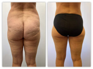 Before and After Image