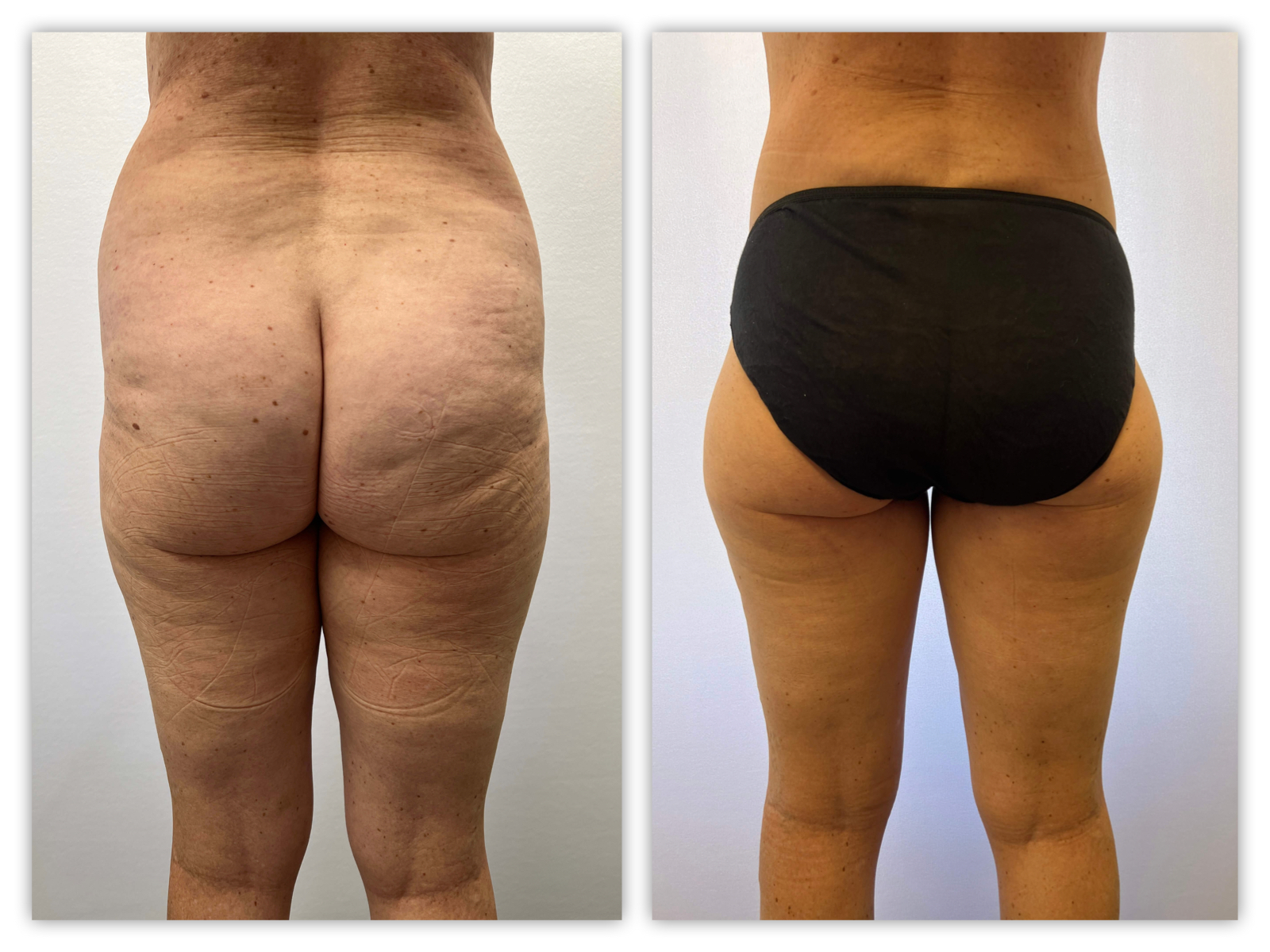 Before and After Image