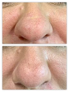 Before and After Image