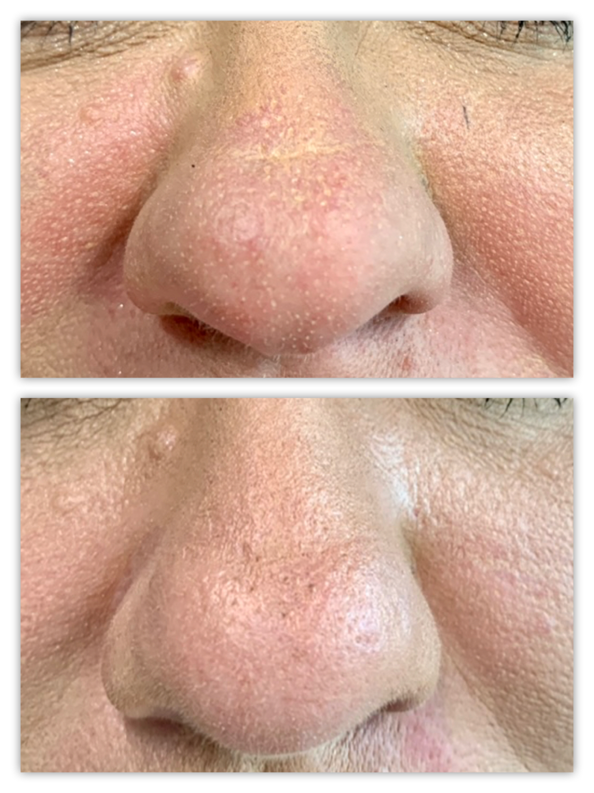 Before and After Image