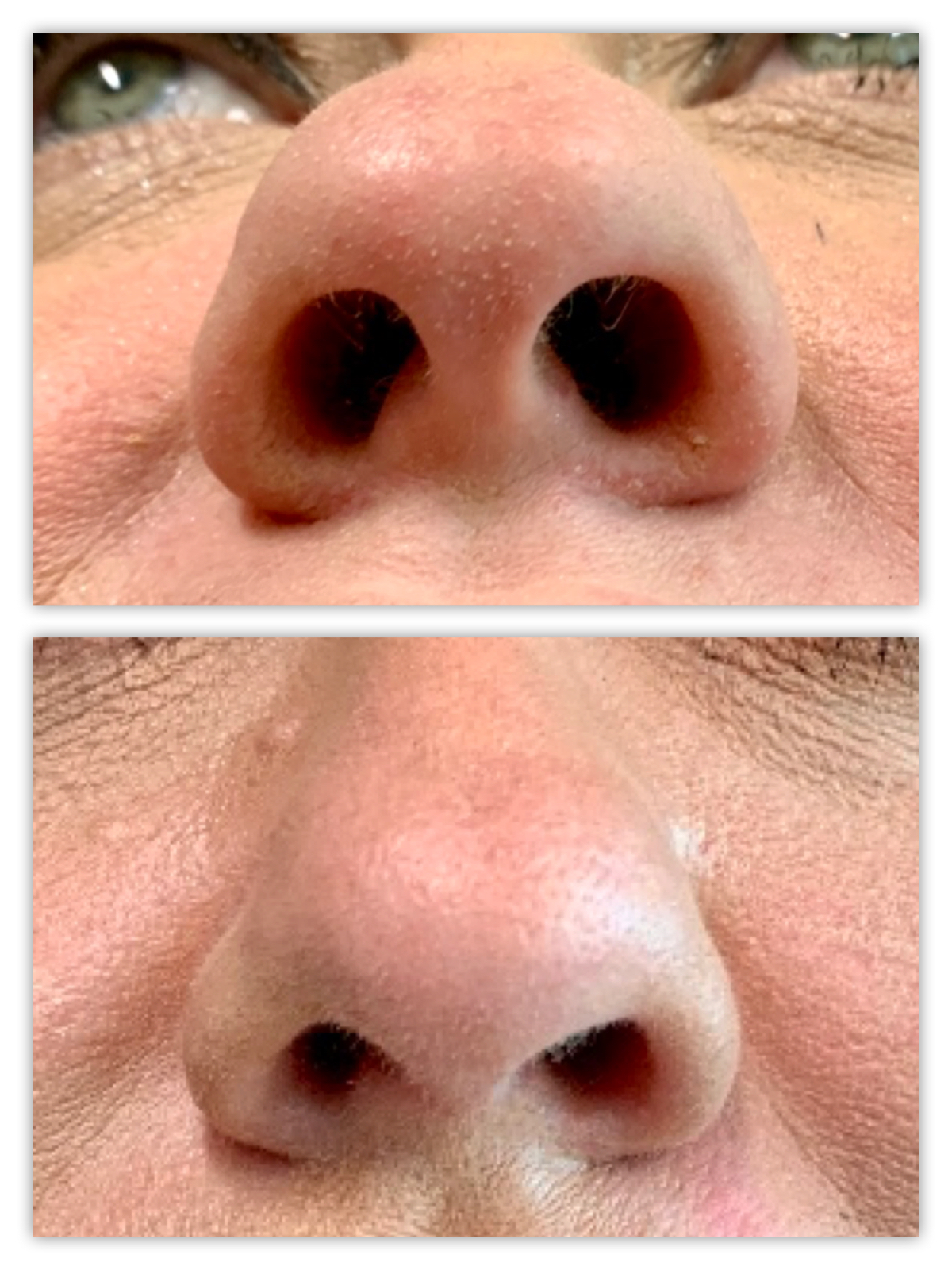 Before and After Image
