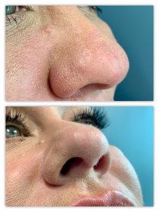 Before and After Image