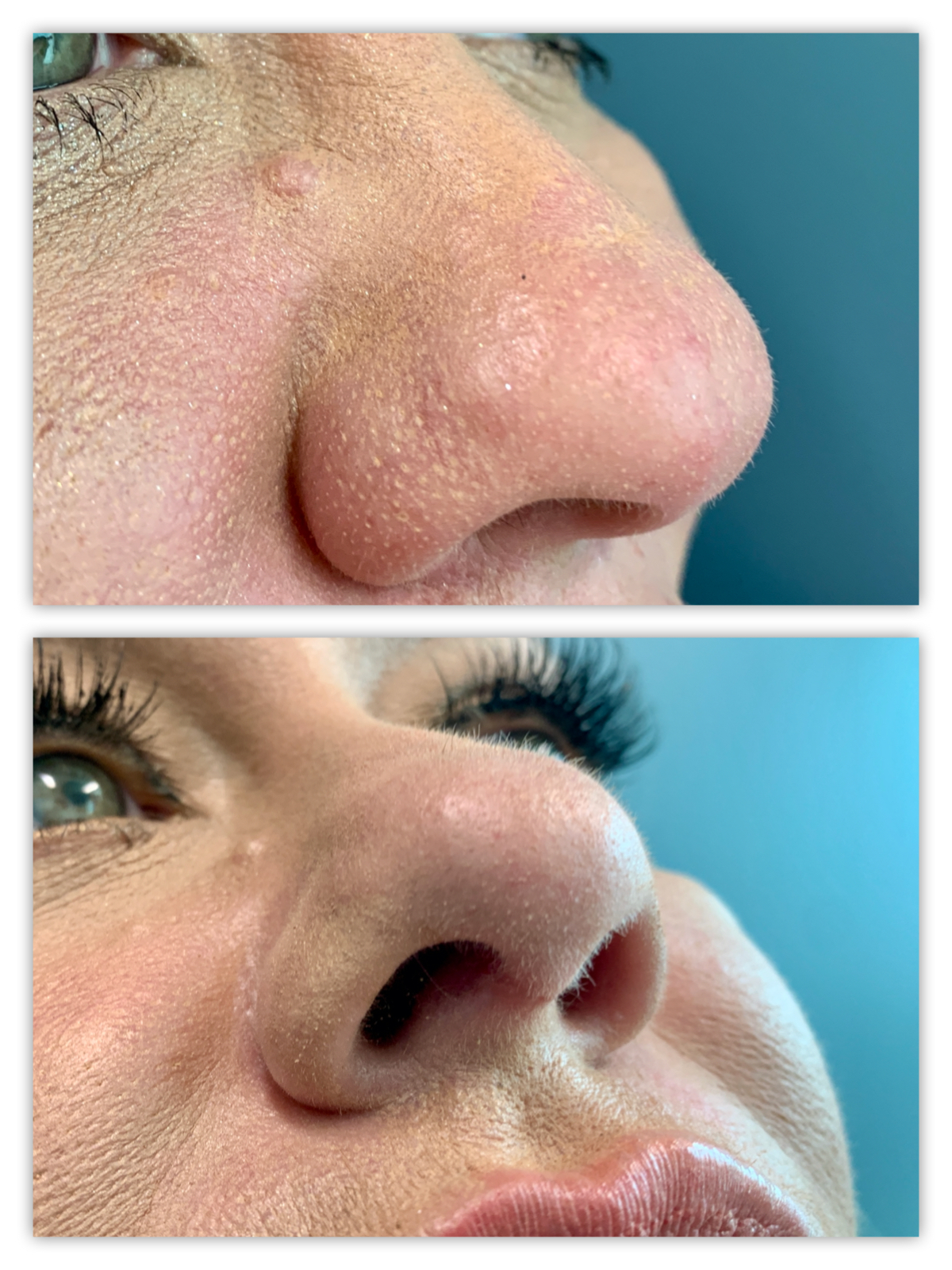 Before and After Image
