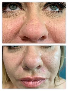 Before and After Image