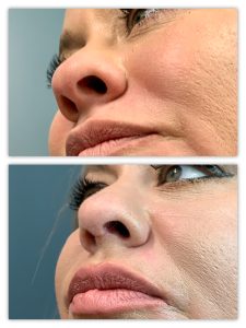 Before and After Image