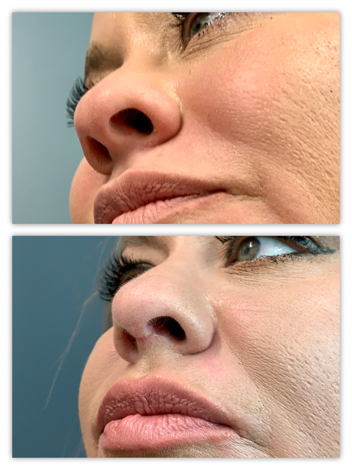 Before and After Image