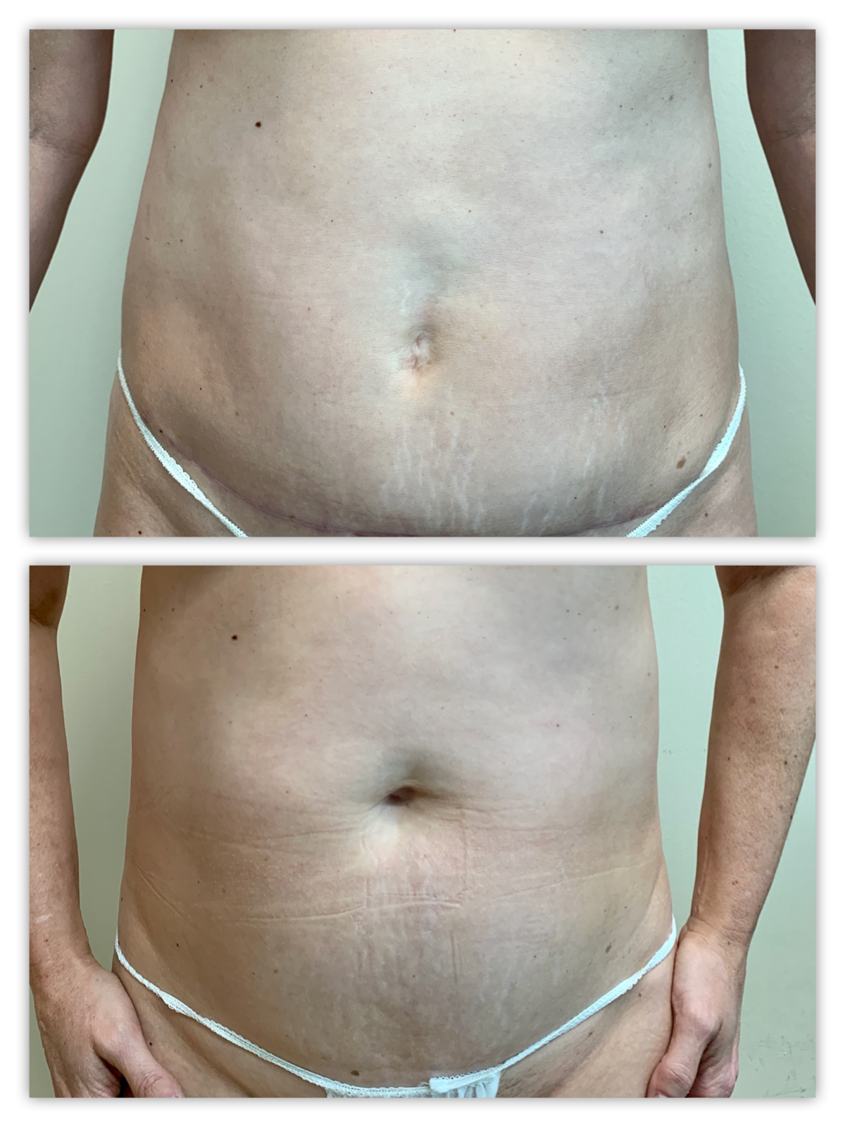 Before and After Image