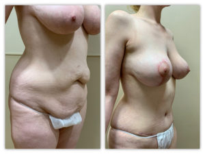 Before and After Image