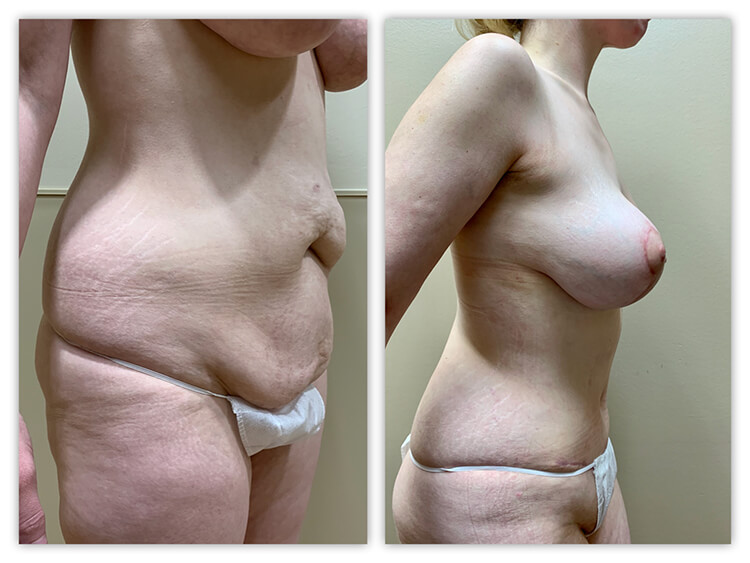 Before and After Image