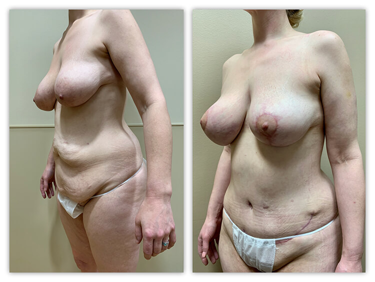 Before and After Image