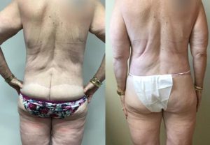 Before and After Image