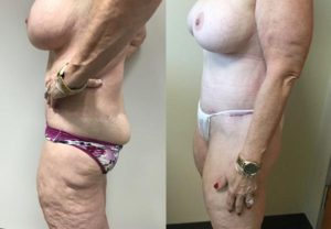 Before and After Image