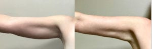 Before and After Image
